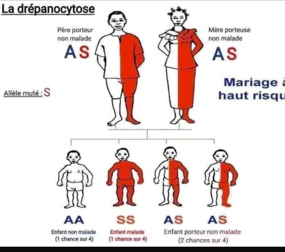 JOURNEE MONDIALE DE LA DREPANOCYTOSE